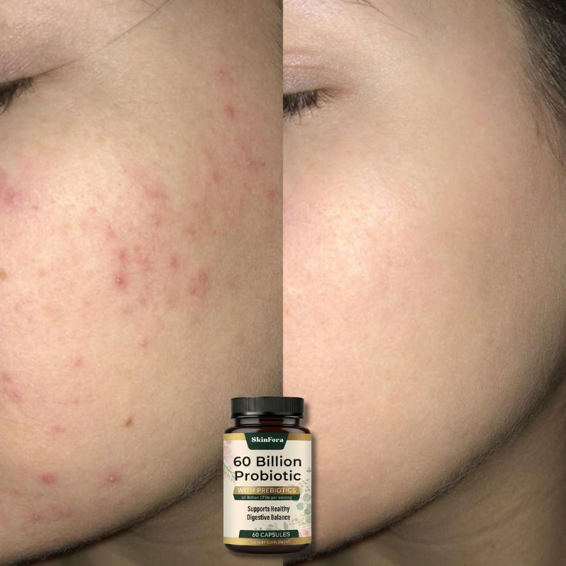 SkinFora™ Probiotik-Kapseln