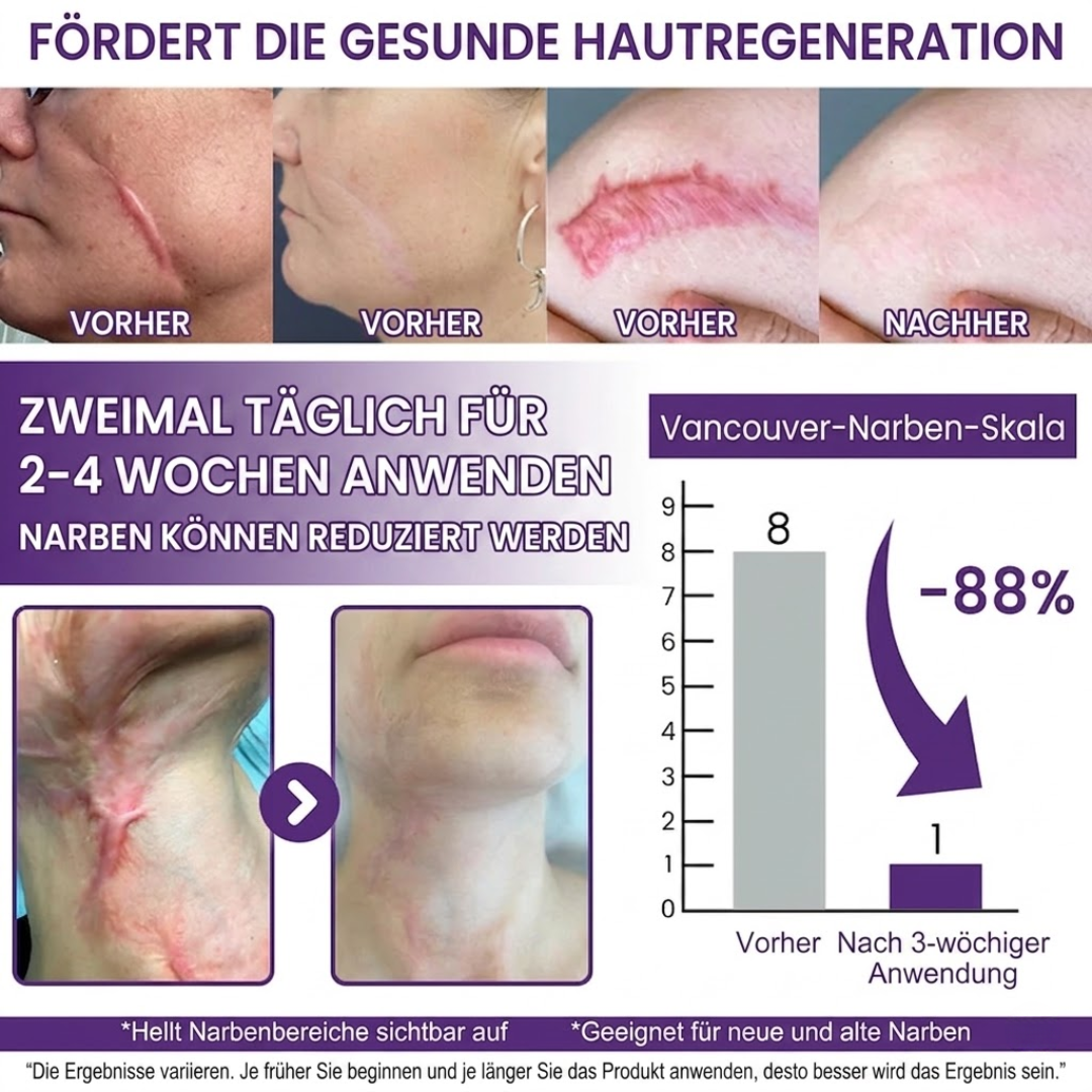 ReGenScar™ | Stammzellen-Narbengel