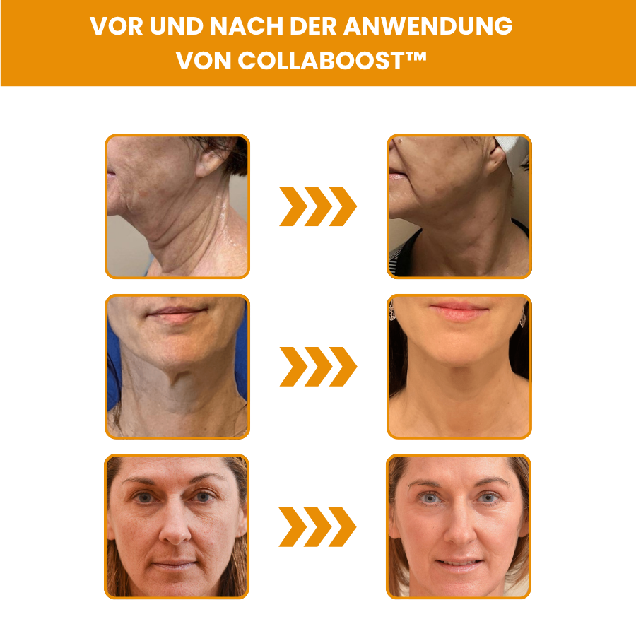 CollaBoost™ Nahrungsergänzungsmittel