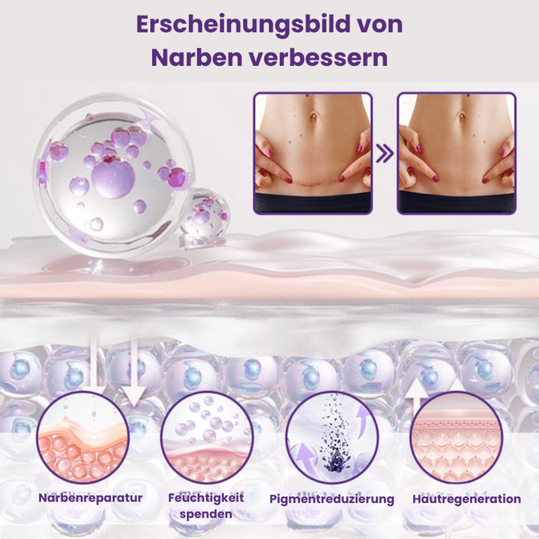ReGenScar™ | Stammzellen-Narbengel