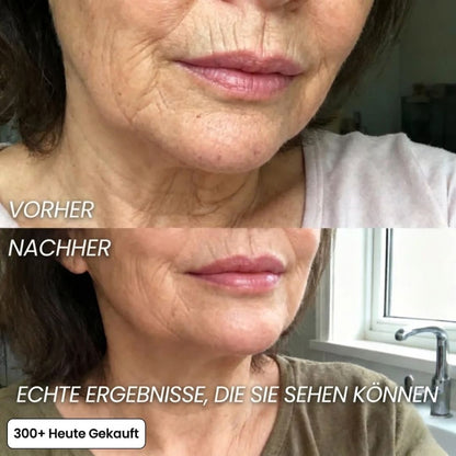 LineSmooth™ | Anti-Aging Gesichtscreme