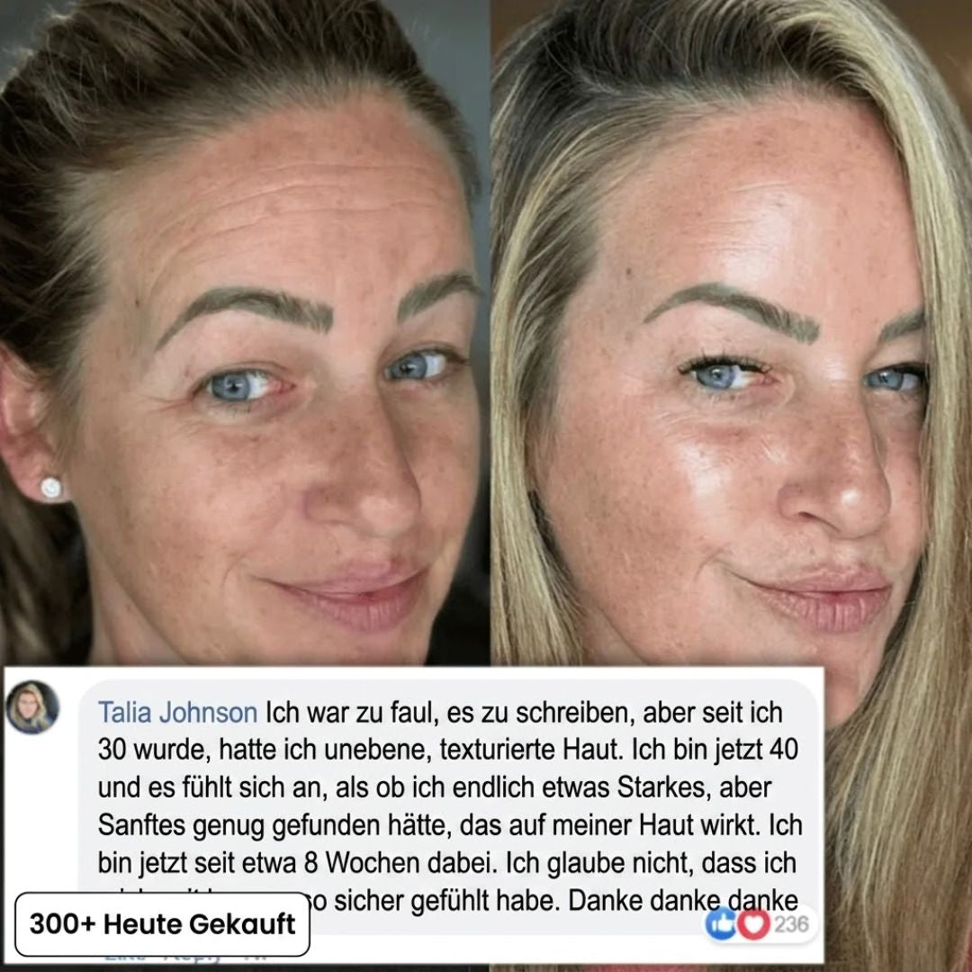 LineSmooth™ | Anti-Aging Gesichtscreme