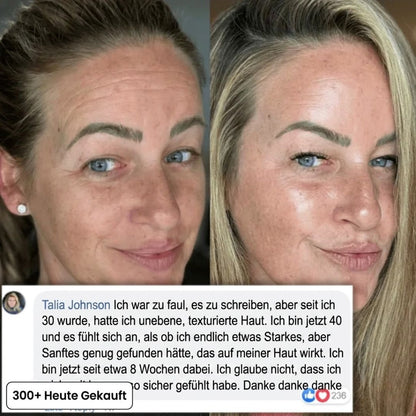 LineSmooth™ | Anti-Aging Gesichtscreme