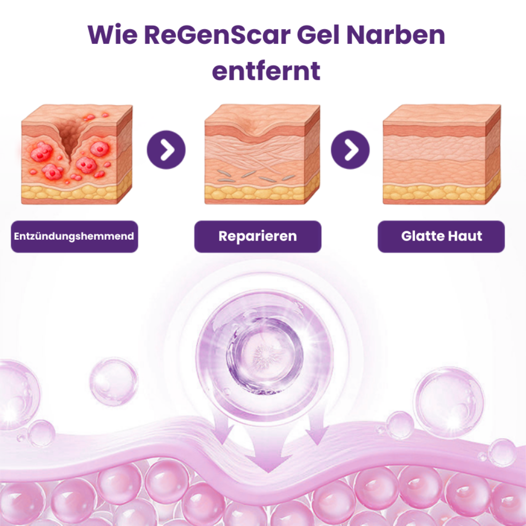 ReGenScar™ | Stammzellen-Narbengel