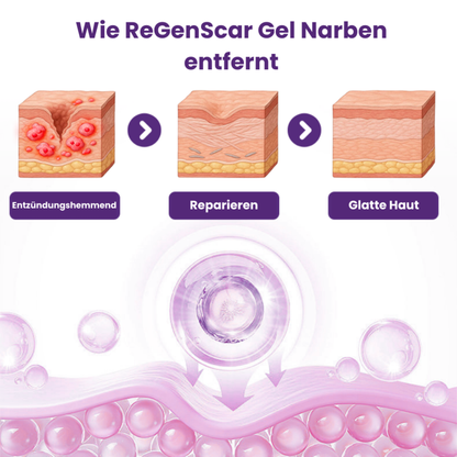 ReGenScar™ | Stammzellen-Narbengel