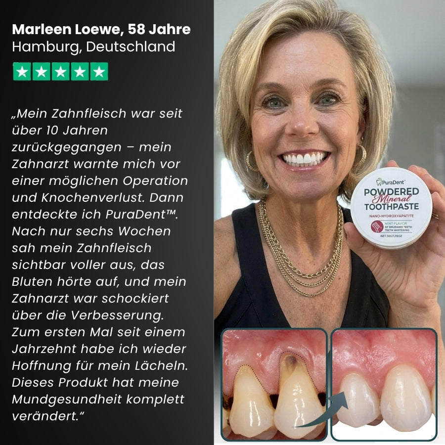 PuraDent™ | Mineralisch aktiviertes Zahnpulver