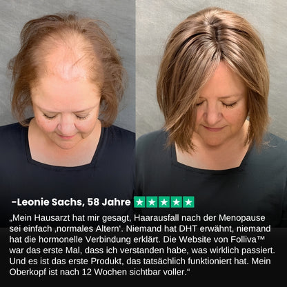 Folliva™ | Haarwuchs-Spray