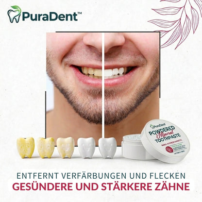 PuraDent™ | Mineralisch aktiviertes Zahnpulver