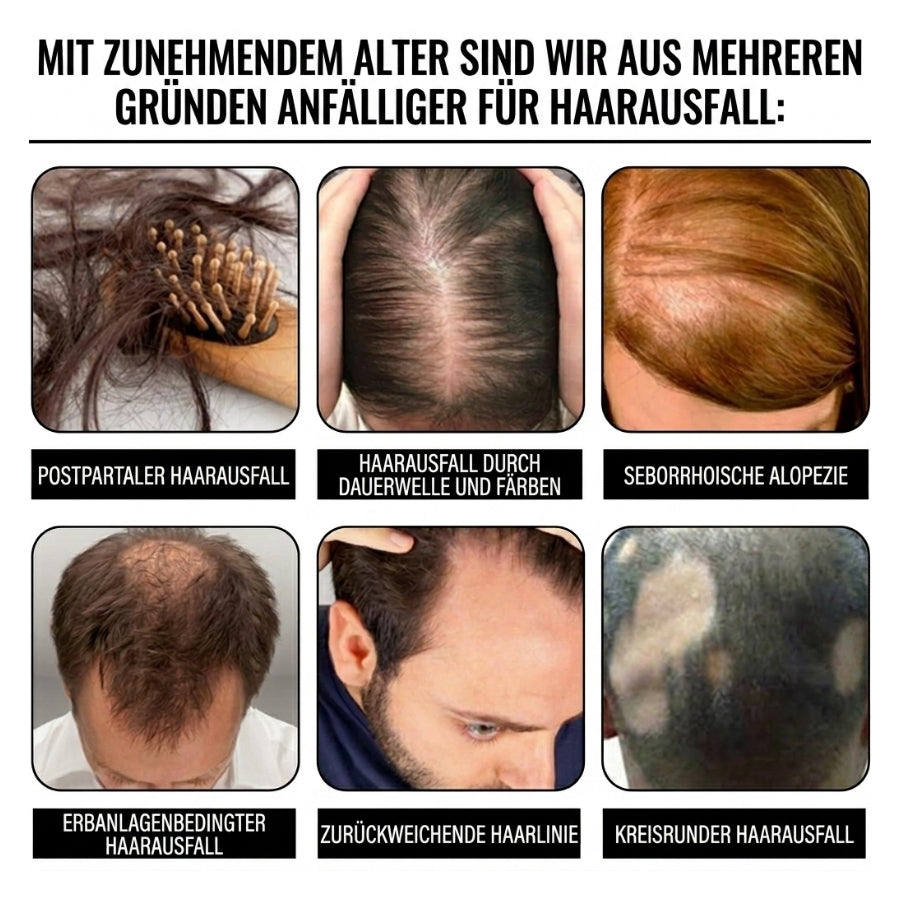 Folliva™ | Haarwuchs-Spray