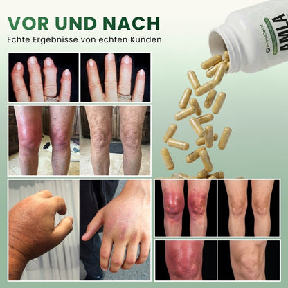 PrimeJoint™ | Amla Superfruit Kapseln