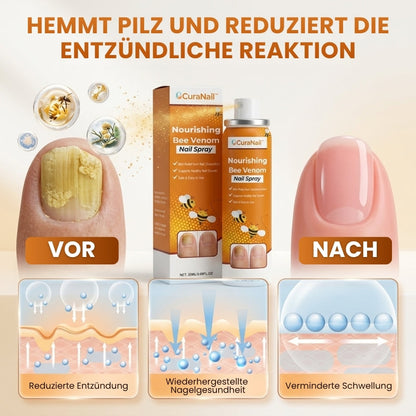 CuraNail™ |  Antipilz-Spray