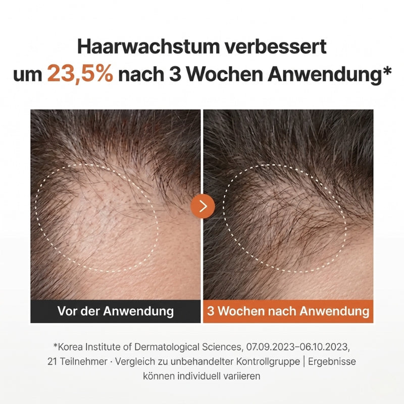 Lustria™ | Leave-On-Formel gegen Haarausfall