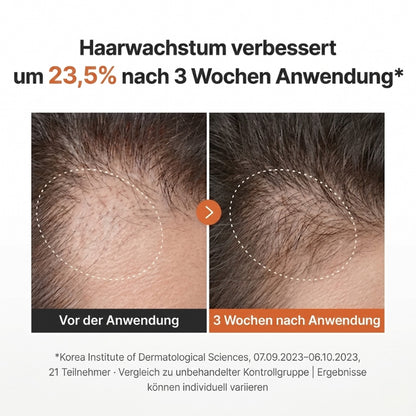 Lustria™ | Leave-On-Formel gegen Haarausfall