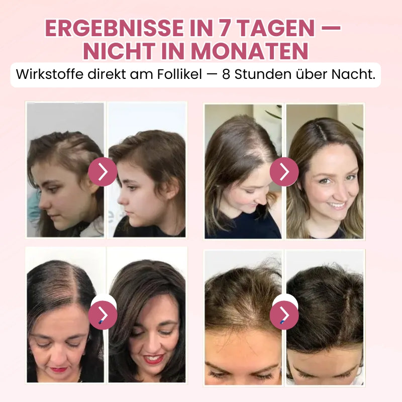 Lustria™ | Leave-On-Formel gegen Haarausfall