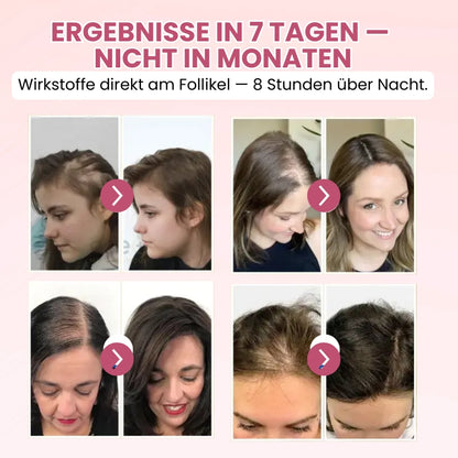Lustria™ | Leave-On-Formel gegen Haarausfall