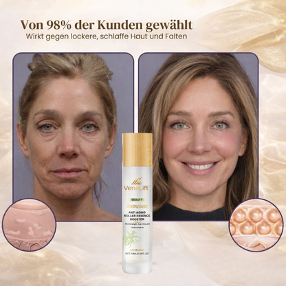 VenaLift™ | Gesichtsroller