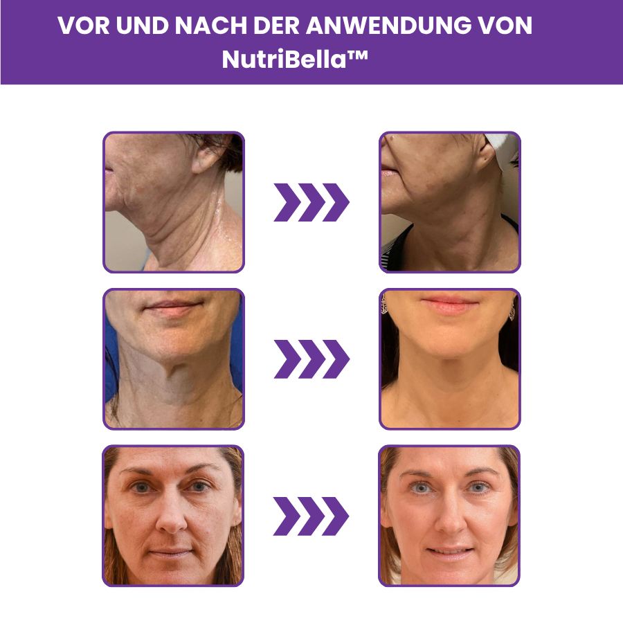 NutriBella™ Resveratrol Kapseln