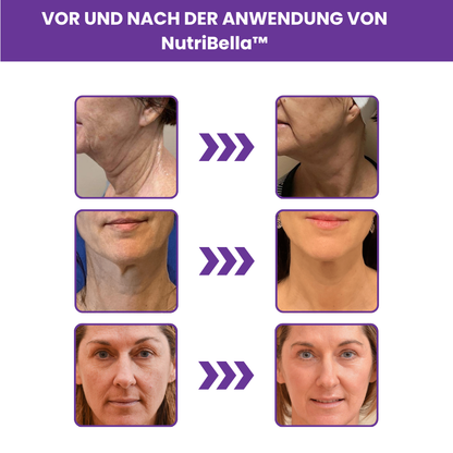 NutriBella™ Resveratrol Kapseln